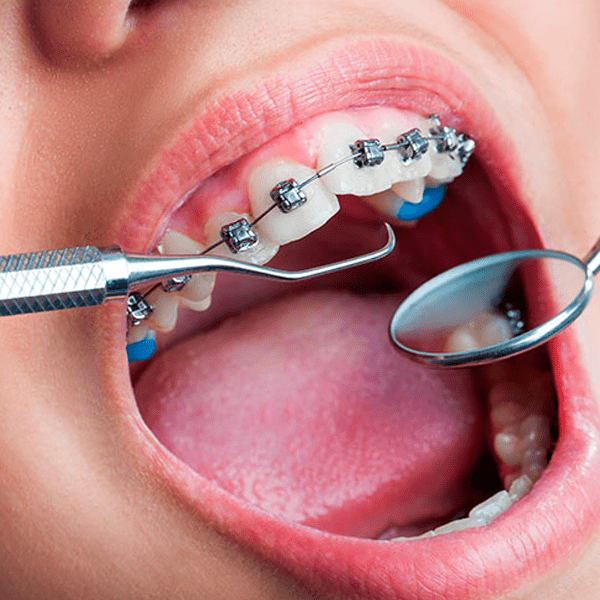 Ortodontia - 